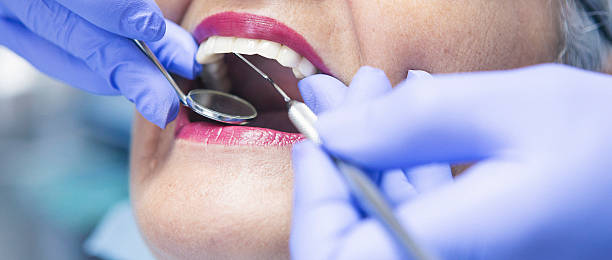 Best Emergency Treatment for Dental Infections or Abscesses in Quantico Base, VA